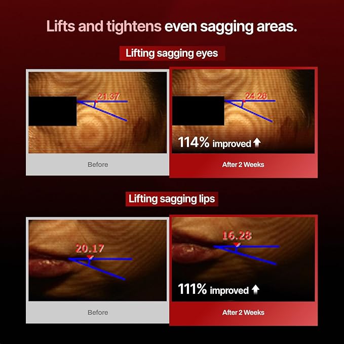 MEDITHERAPY Wrinkle-fit Tangle Eye Patch & Wrinkle-fit Face Mask - Under Eye Mask and Eye Cream for Eye Bags, Puffiness, and Dark Circles - Firming and Tightening Korean Collagen Mask