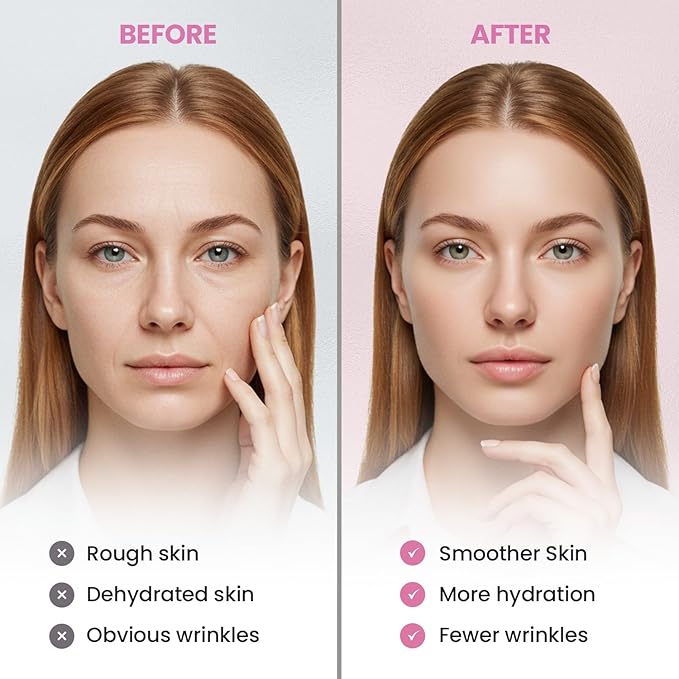 (BUNDLE) Facial and Forehead Wrinkle Patches: Face Wrinkle Treatment for Forehead, Smile Line, Under Eye- Anti Wrinkle Patches